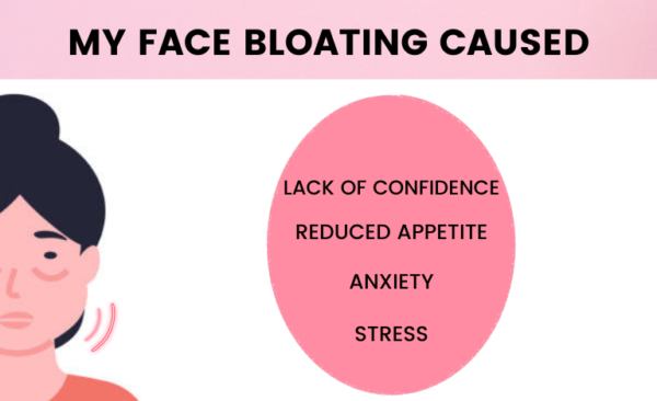 MY FACE BLOATING CAUSED 600x366 