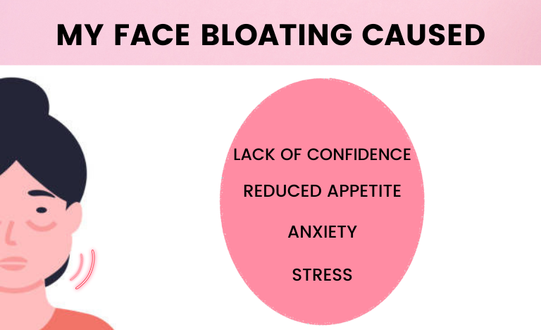 4 quick ways to reduce face bloating (#3 will SURPRISE you)