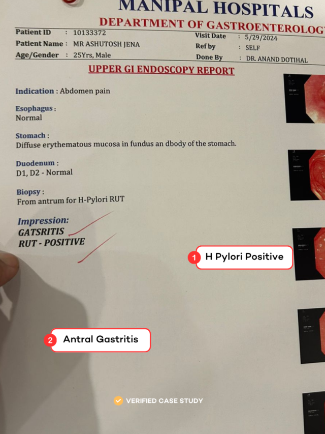 H Pylori in 8 Days